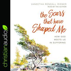 Scars That Have Shaped Me by Vaneetha Rendall Risner audiobook