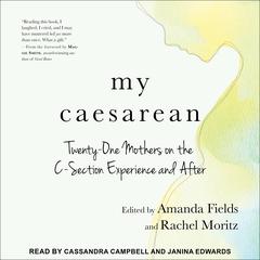 My Caesarean by various authors audiobook