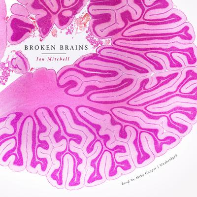 Broken Brains by Ian Mitchell audiobook