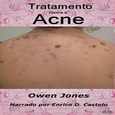Tratamento contra a acne by Owen Jones audiobook