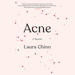Acne by Laura Chinn audiobook