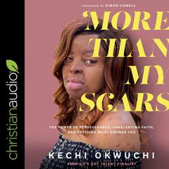 More Than My Scars by Kechi Okwuchi audiobook