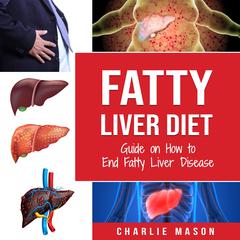 Fatty Liver Diet: Guide on How to End Fatty Liver Disease Fatty Liver Diet Books: Fatty Liver Diet by Charlie Mason audiobook