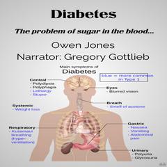 Diabetes by Owen Jones audiobook