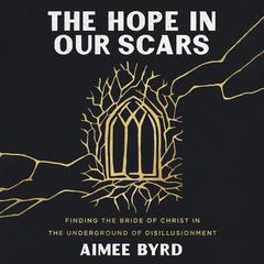 The Hope in Our Scars by Aimee Byrd audiobook