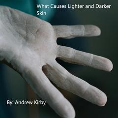 What Causes Lighter and Darker Skin by Andrew Kirby audiobook